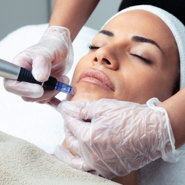 Micro Needling